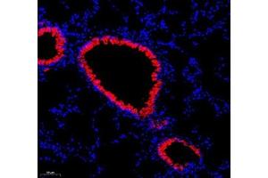 Immunofluorescence of paraffin embedded mouse lung using ATP6V1C2 (ABIN7073157) at dilution of 1:200 (200x lens) (ATP6V1C2 antibody)