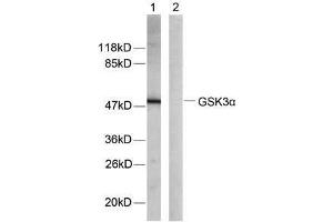 Western blot analysis of extracts from ovary cancer cells using GSK3α (Ab-21) antibody (E021007) (GSK3 alpha antibody)