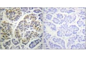 Immunohistochemistry analysis of paraffin-embedded human pancreas, using 14-3-3 thet/tau (Phospho-Ser232) Antibody. (14-3-3 theta antibody  (pSer232))