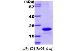 SDS-PAGE (SDS) image for Ubiquitin-Conjugating Enzyme E2L 6 (UBE2L6) (AA 1-152) protein (His tag) (ABIN667729)