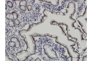 Immunoperoxidase of monoclonal antibody to API5 on formalin-fixed paraffin-embedded human small Intestine. (Apoptosis Inhibitor 5 antibody  (AA 400-504))