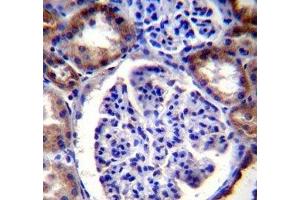 RICTOR antibody immunohistochemistry analysis in formalin fixed and paraffin embedded human kidney tissue. (RICTOR antibody  (AA 1617-1650))