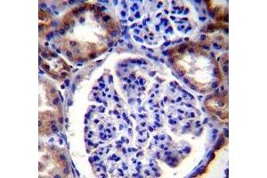 RICTOR antibody immunohistochemistry analysis in formalin fixed and paraffin embedded human kidney tissue.