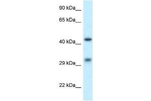 Western Blot showing SCARB2 antibody used at a concentration of 1 ug/ml against THP-1 Cell Lysate (SCARB2 antibody  (N-Term))