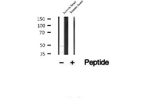 Western blot analysis of extracts of human heart tissue, using CFHR3 antibody. (CFHR3 antibody)