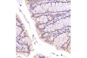 Immunohistochemistry of paraffin embedded rat rectum using SR140 (ABIN7076091) at dilution of 1:1000 (400x lens) (SR140 antibody)