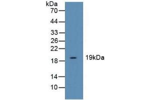 Figure. (Cofilin antibody  (AA 3-161))