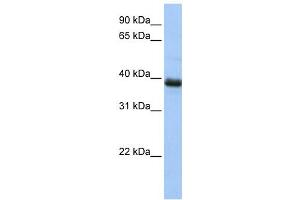 Western Blotting (WB) image for anti-SPO11 Meiotic Protein Covalently Bound To DSB Homolog (SPO11) antibody (ABIN2459829) (SPO11 antibody)