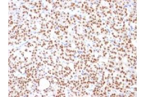 Immunohistochemistry (IHC) image for anti-Paired Box 8 (PAX8) (AA 60-261) antibody (ABIN4949848)