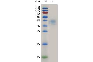 CD52 (CD52) (AA 25-36) protein (Fc Tag)