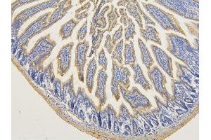IHC analysis of RNF123 using anti-RNF123 antibody (ABIN6719387). (RNF123 antibody  (AA 12-188))