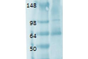 Western Blot analysis of Human thyroid lysate showing detection of Sodium Iodide Symporter protein using Mouse Anti-Sodium Iodide Symporter Monoclonal Antibody, Clone 14F . (SLC5A5 antibody  (AA 468-643) (Biotin))