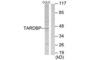 Western blot analysis of extracts from COLO205 cells, using TBX1 antibody. (T-Box 1 antibody  (C-Term))