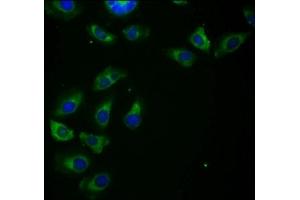 Immunofluorescence staining of A549 cells with ABIN7155085 at 1:266, counter-stained with DAPI. (HHLA2 antibody  (AA 172-258))