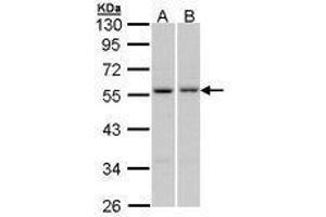 Image no. 1 for anti-Paired Box 6 (PAX6) (AA 1-221) antibody (ABIN467590) (PAX6 antibody  (AA 1-221))