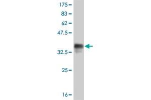 Western Blotting (WB) image for anti-Forkhead Box C2 (MFH-1, Mesenchyme Forkhead 1) (FOXC2) (AA 156-256) antibody (ABIN515705)