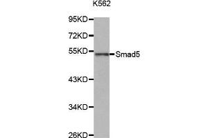 Western Blotting (WB) image for anti-SMAD, Mothers Against DPP Homolog 5 (SMAD5) (AA 140-240) antibody (ABIN6213914) (SMAD5 antibody  (AA 140-240))