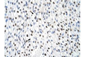 MSI2 antibody was used for immunohistochemistry at a concentration of 4-8 ug/ml to stain Myocardial cells (arrows) in Human Heart. (MSI2 antibody)