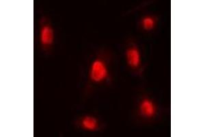 Immunofluorescent analysis of p300 staining in HEK293T cells. (p300 antibody  (N-Term))