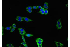 Immunofluorescent analysis of HepG2 cells using ABIN7171345 at dilution of 1:100 and Alexa Fluor 488-congugated AffiniPure Goat Anti-Rabbit IgG(H+L) (TIGIT antibody  (AA 22-141))