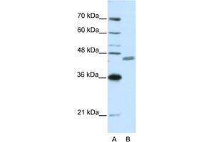 Western Blotting (WB) image for anti-Zinc Finger Protein 396 (ZNF396) antibody (ABIN2461984) (ZNF396 antibody)