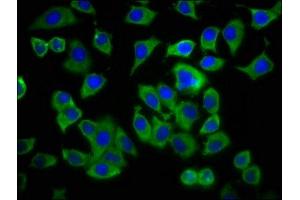 Immunofluorescence staining of A549 cells with ABIN7143338 at 1:233, counter-stained with DAPI. (ADCY8 antibody  (AA 534-670))