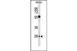 Western blot analysis of MED6 Antibody (Center) in WiDr cell line lysates (35ug/lane). (MED6 antibody  (Middle Region))