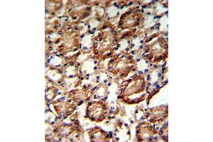 Formalin-fixed and paraffin-embedded kidney tissue reacted with GS Antibody (C-term), which was peroxidase-conjugated to the secondary antibody, followed by DAB staining. (GMP Synthase antibody  (C-Term))