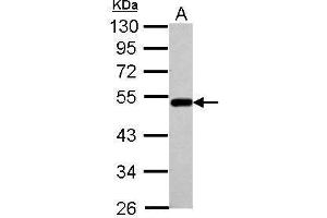 WB Image Sample (30 ug of whole cell lysate) A: A549 10% SDS PAGE antibody diluted at 1:1000 (BLMH antibody)