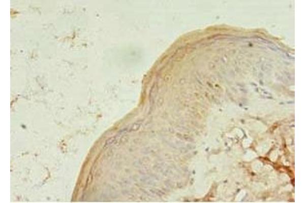 TCHP antibody  (AA 1-498)