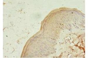 Immunohistochemistry of paraffin-embedded human skin tissue using ABIN7173373 at dilution of 1:100 (TCHP antibody  (AA 1-498))