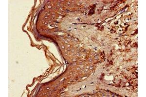Immunohistochemistry of paraffin-embedded human skin tissue using ABIN7167757 at dilution of 1:100 (FAM134B antibody  (AA 1-131))