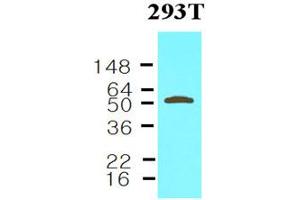 Western blot analysis: Cell lysates of 293T (30ug) were resolved by SDS-PAGE, transferred to NC membrane and probed with anti-human Visfatin (1:1000). (NAMPT antibody)