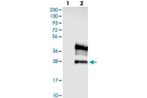 Western blot analysis of Lane 1: Negative control (vector only transfected HEK293T lysate), Lane 2: Over-expression Lysate (Co-expressed with a C-terminal myc-DDK tag (~3. (FXYD5 antibody)
