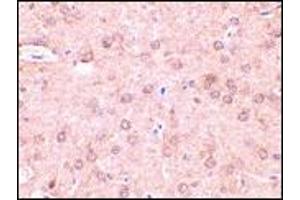 AP20054PU-N Beclin-1 antibody staining of Rat brain tissue by Immunohistochemistry at 2 μg/ml. (Beclin 1 antibody  (N-Term))