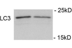 Western Blotting (WB) image for anti-Microtubule-Associated Protein 1 Light Chain 3 gamma (MAP1LC3C) (pSer12) antibody (ABIN2970987) (LC3C antibody  (pSer12))