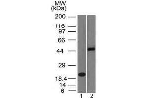 Western blot testing of 1) human partial recombinant protein and 2) human Raji cell lysate with PAX8 antibody (clone PAX8/1492). (PAX8 antibody  (AA 60-261))