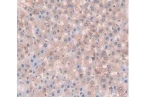 IHC-P analysis of Rat Tissue, with DAB staining. (APC antibody  (AA 2634-2842))
