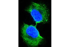 Immunocytochemistry (ICC) image for anti-Glutathione S-Transferase pi 1 (GSTP1) antibody (ABIN2983291) (GSTP1 antibody)