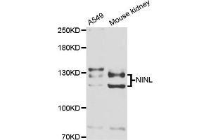Western blot analysis of extracts of various cell lines, using NINL antibody (ABIN5974637) at 1/1000 dilution. (NINL antibody)