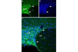 Expression of NALCN in rat hypothalamus - Immunohistochemical staining of rat hypothalamus using Anti-NALCN/VGCNL1 (extracellular) Antibody (ABIN7043658 and ABIN7045249). (NALCN antibody  (Domain 3, Extracellular))