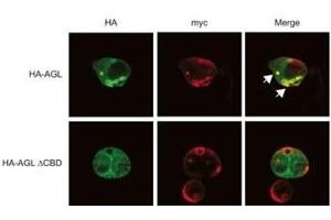 Expression of myc-GS causes wild type but not the ACBD mutant of AGL to aggregate around the S-stain-positive inclusions. (AGL antibody  (C-Term))