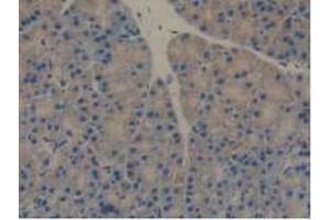 Figure. (REG3B antibody  (AA 27-175))