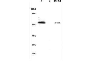 Lane 1: mouse embryo lysates Lane 2: mouse brain lysates probed with Anti Phospho-IRF7 (Ser471/472) Polyclonal Antibody, Unconjugated (ABIN742703) at 1:200 in 4 °C. (IRF7 antibody  (pSer471, pSer472))