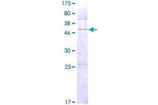 DHRS4L2 Protein (AA 1-230) (GST tag)