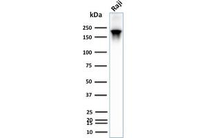 Western Blotting (WB) image for anti-Protein tyrosine Phosphatase, Receptor Type, C (PTPRC) antibody (ABIN6940470)