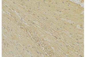 ABIN6274153 at 1/100 staining Mouse muscle tissue by IHC-P.