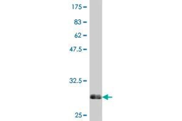 SRD5A2 anticorps  (AA 28-65)