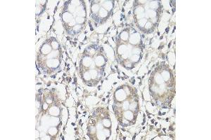 Immunohistochemistry of paraffin-embedded human colon using PTK2 antibody. (FAK antibody  (AA 700-800))