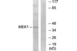 Western blot analysis of extracts from K562 cells, treated with, using MEK1 (Ab-291) Antibody. (MEK1 antibody  (AA 261-310))